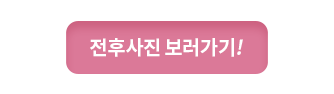 전후사진